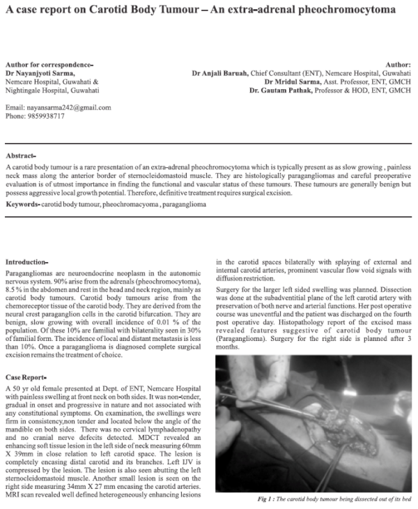 A Case Report on Carotod Body Tumour - An Extra-adrenal Pheochromocytoma