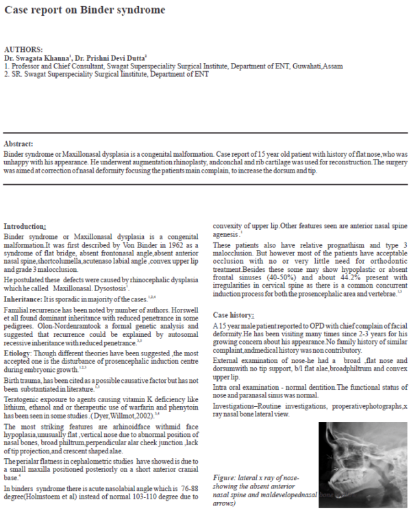 Case Report on Binder Syndrome