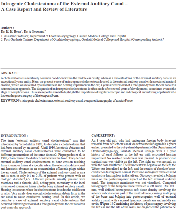 Iatrogenic Cholesteatoma of the External Auditory Canal - A Case Report and Review of Literature