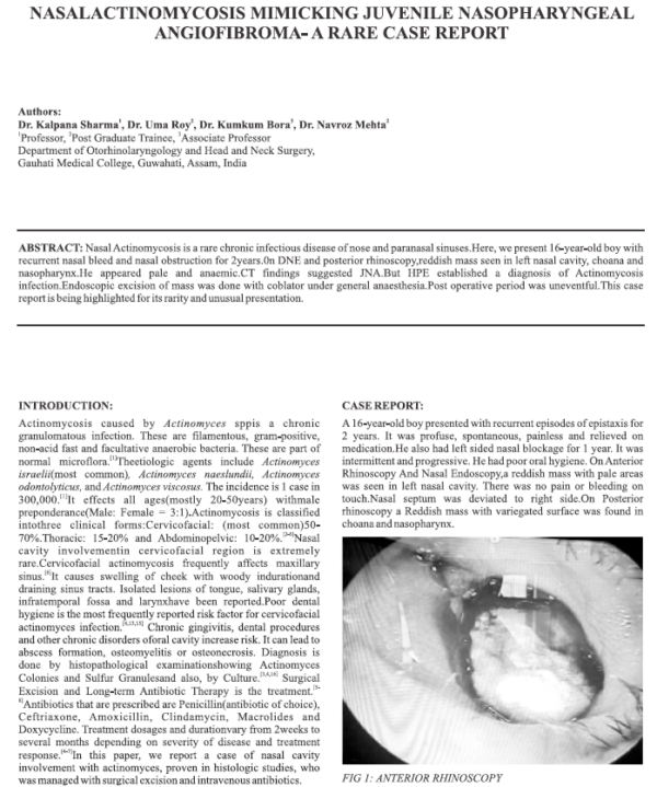 Nasalactinomycosis Mimicking Juvenile Nasopharyngeal Angiofibroma