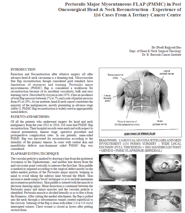 Pectoralis Major Myocutaneous Flap (PMMC) in Post Oncosurgical Head & Neck Reconstruction